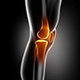 Nonoperative Treatments for ACL Injuries
