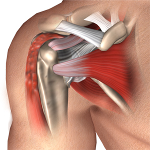 Biceps Tenodesis